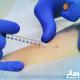 Anesthesia Service for Ambulatory Surgery Windy City Anesthesia