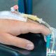 4 Great Benefits of Intravenous Sedation (IV)