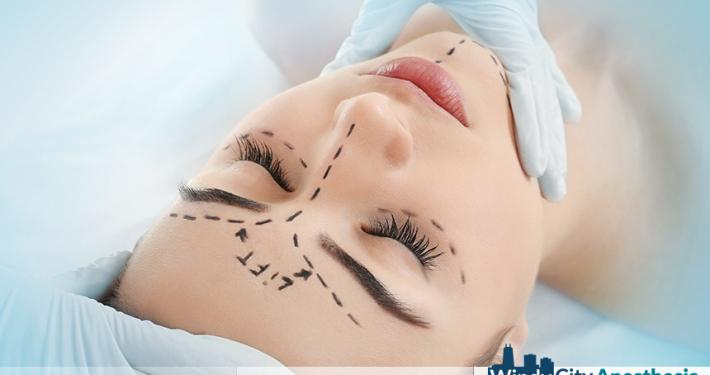 Facelift Sedation: Boosting Surgical Efficiency, Patient Safety, and the Role of the Anesthesia Team