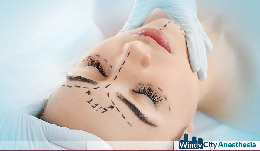 Facelift Sedation: Boosting Surgical Efficiency, Patient Safety, and the Role of the Anesthesia Team Facelift Sedation: Boosting Surgical Efficiency, Patient Safety, and the Role of the Anesthesia Team
