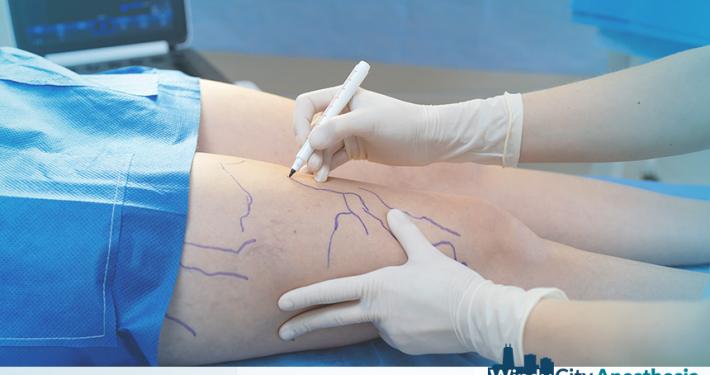 Office Sedation for Vein Clinics: Increase Revenue and Efficiency Without Hospital Dependency