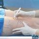 Office Sedation for Vein Clinics: Increase Revenue and Efficiency Without Hospital Dependency