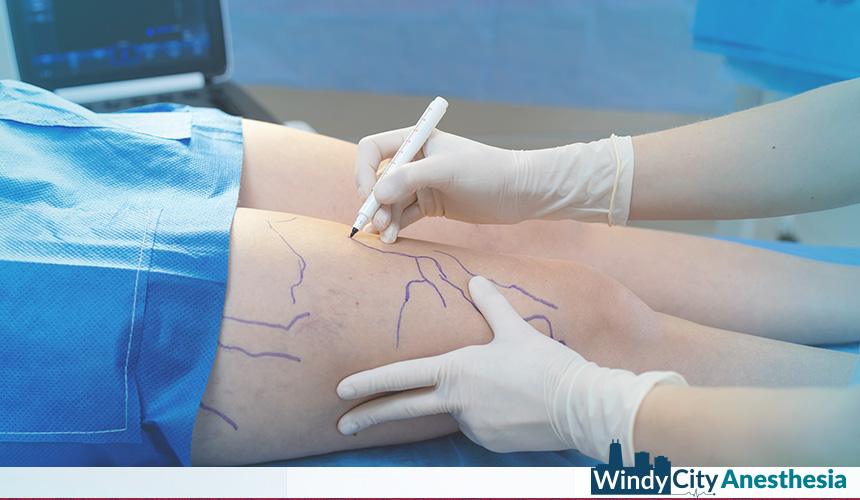 Office Sedation for Vein Clinics: Increase Revenue and Efficiency Without Hospital Dependency